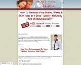 Moles, Warts & Pores and skin Tags Removing – How To Safely & Completely Take away Moles, Warts & Pores and skin Tags