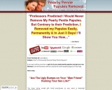 Pearly Penile Papules Elimination – The way to Take away Pearly Panile Papules at Residence