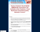 Tonsil Stones Treatment Without end – The 100% Pure Tonsil Stones Treatment!